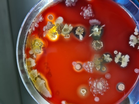 Verschiedene Spezies sporenbildender Bakterien (Bacillus spp.) auf Columbia-Blutagar-Nährboden.